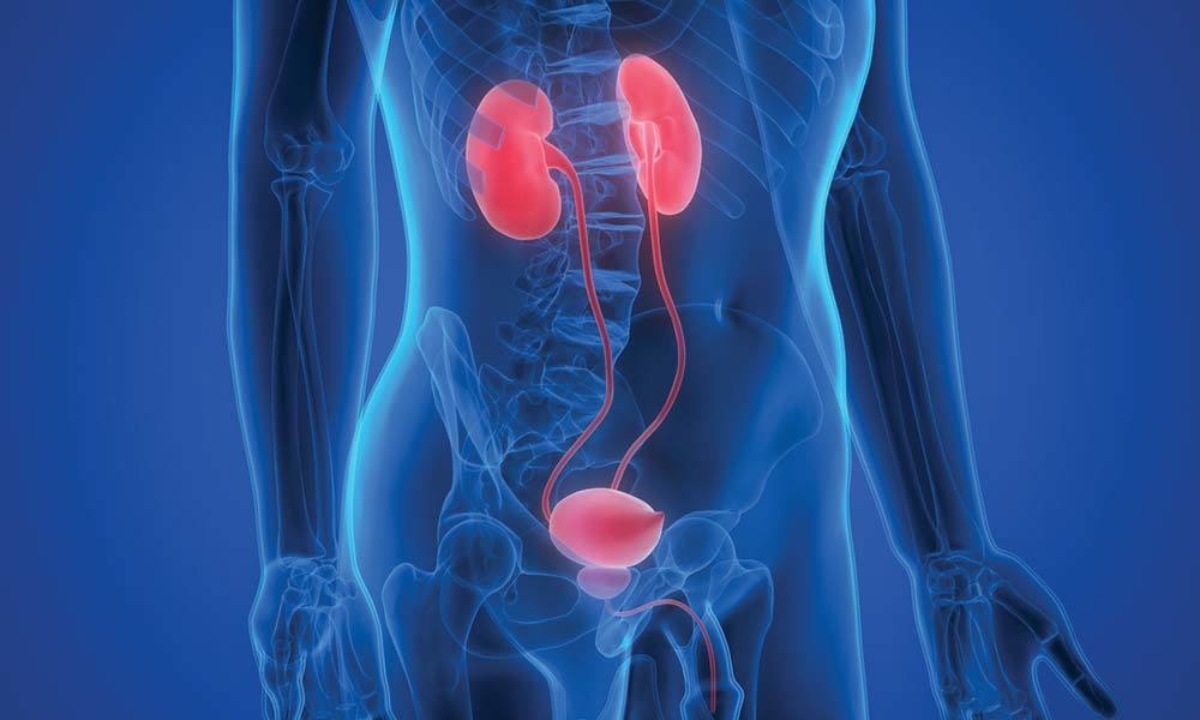 Best Urologist in Panipat