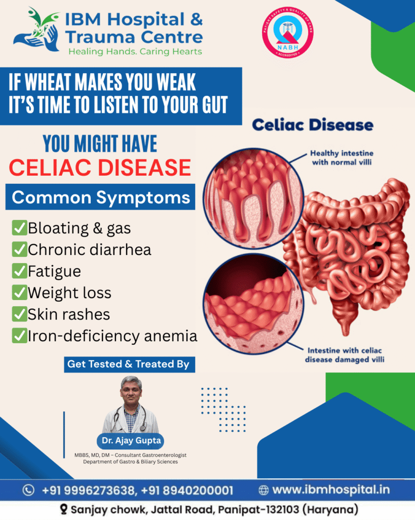 Celiac Disease